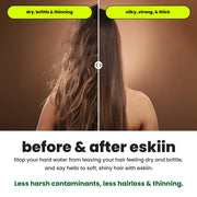 View Eskiin Filtered Showerhead With Filters For Healthy Hair & Skin image 3